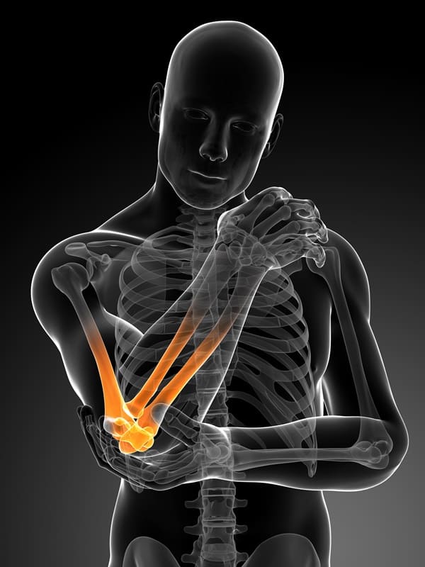 soluciones-medicas-para-epicondilitis-cdmx.jpg