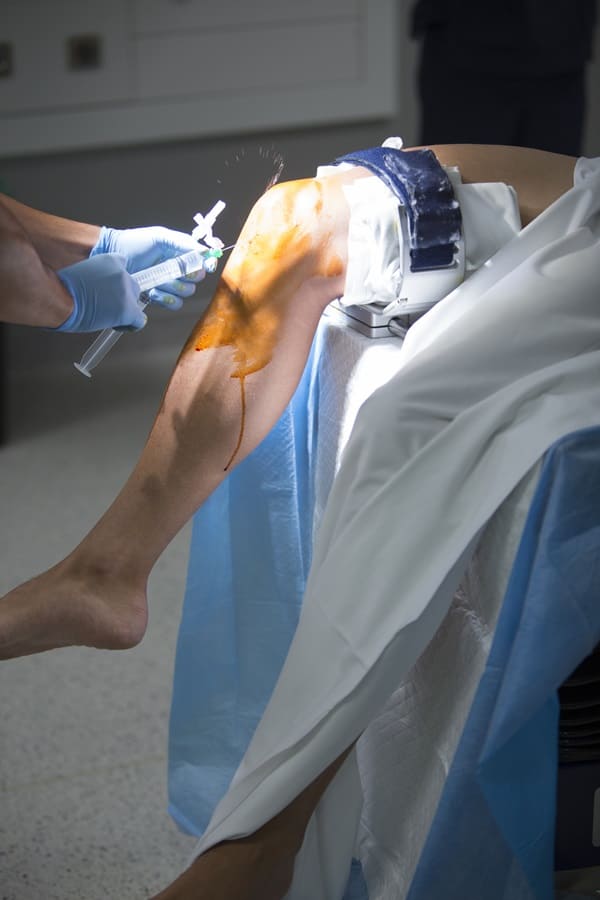 viscosuplementacion-de-rodilla-en-cdmx.jpg