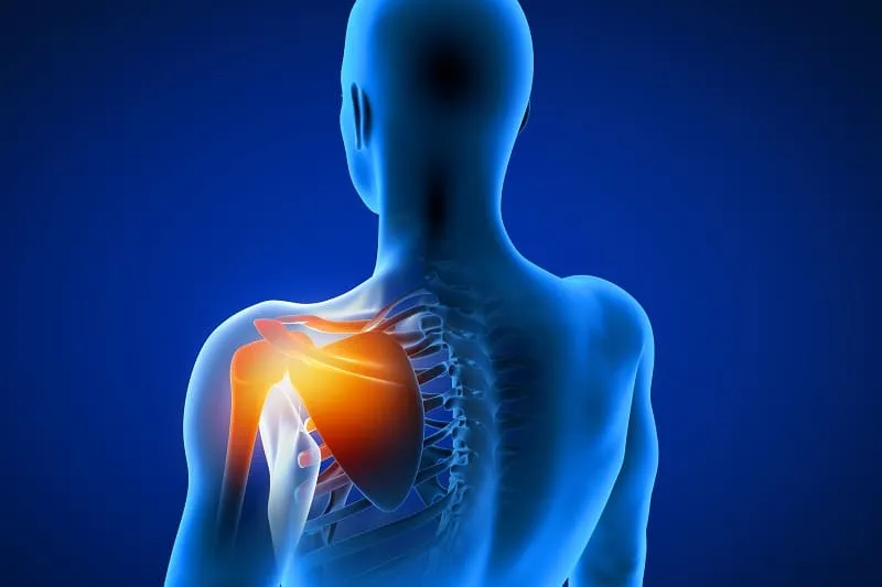 Artroscopía de hombro