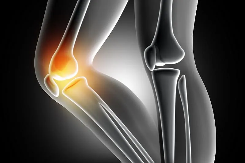 Ruptura de ligamento cruzado anterior ofrecido por Dr. Luis Daniel Ramos Montes
